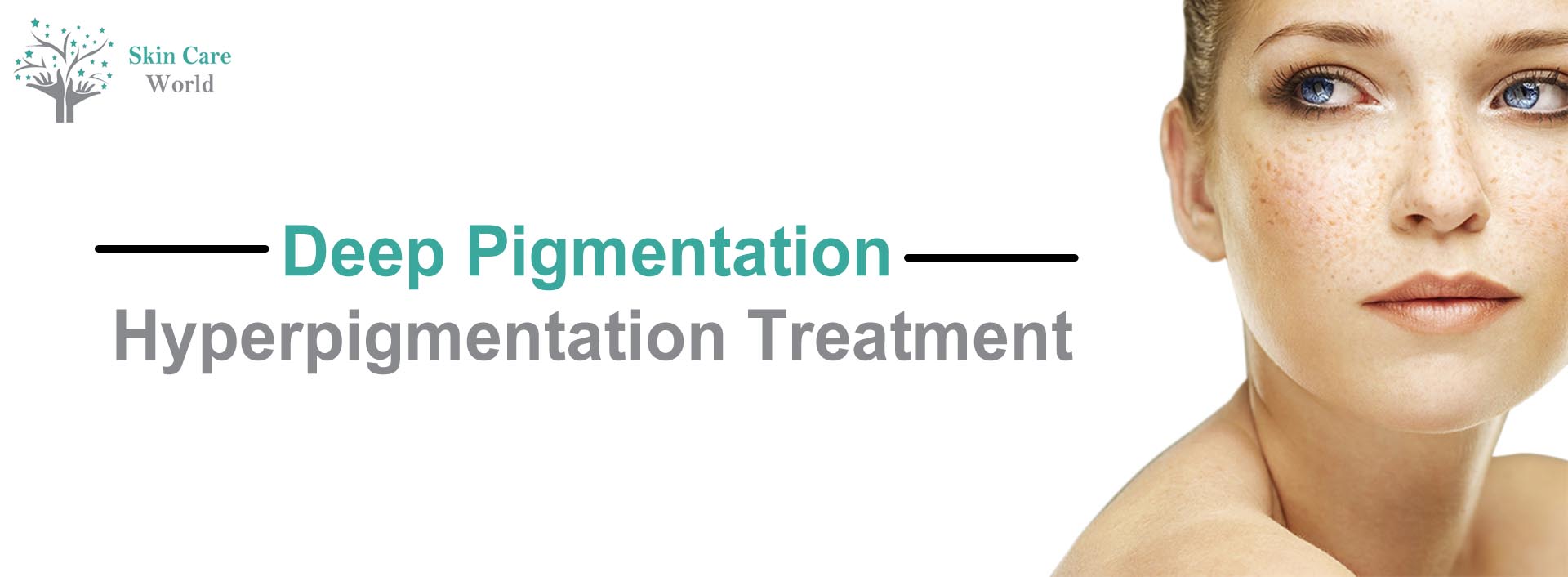Hyperpigmentation treatment in Gurgaon